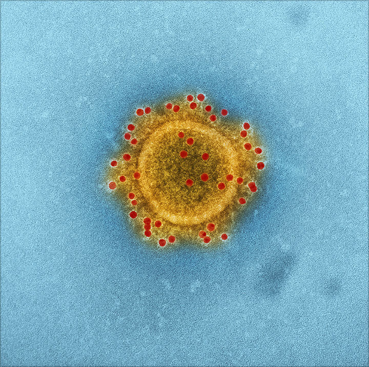Coronavirus-Microscopic-Stock-Image